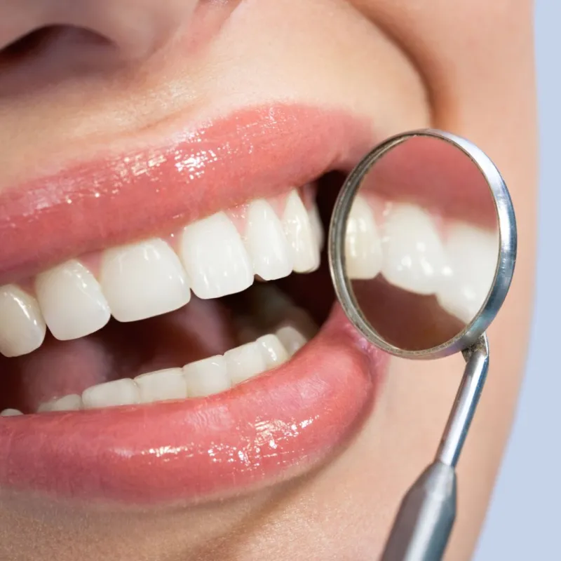 Teeth Cleaning & Scaling