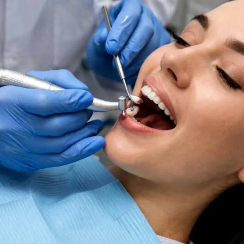 Dental Fillings