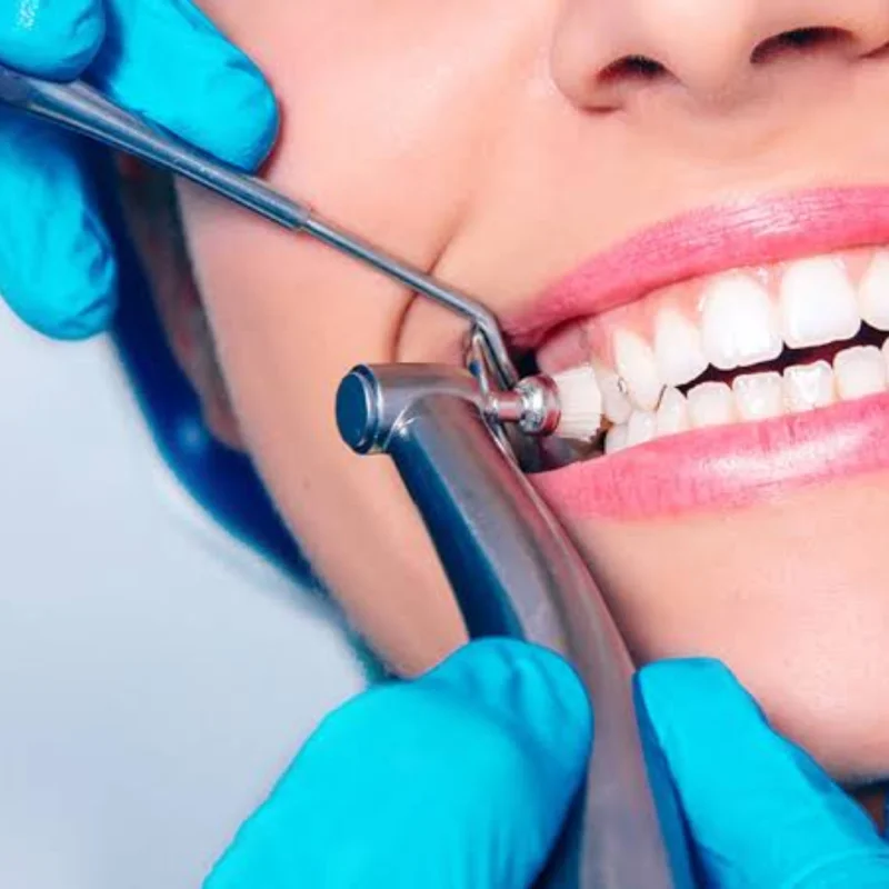 Dental Consultation & Check-Up