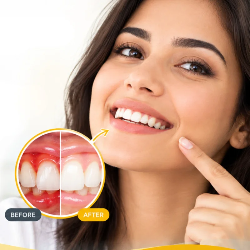 Gum Disease Treatment